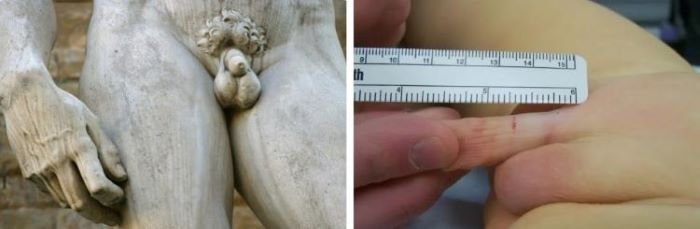 mikropenis_bilder